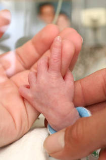 Bebé prematuro con tubos